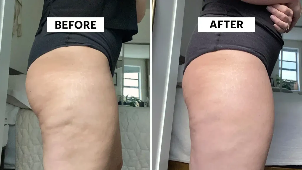 Do Toning Exercise Sunbury Really Tackle Cellulite?