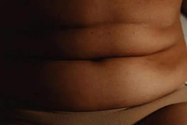 The Hidden Connection: How Stress Shapes Your Fitness and Body Composition 3 image of what stress can do on the stomach area and how Lipo 360 Sunbury can help to change your body shape.